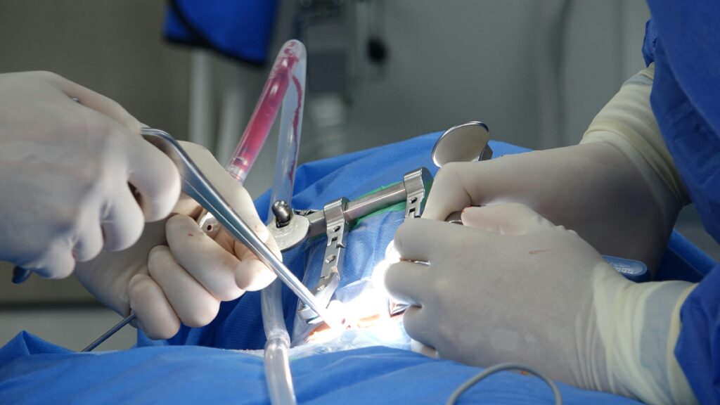Surgeons in an operating room performing spinal surgery with precise tools and sterile equipment.